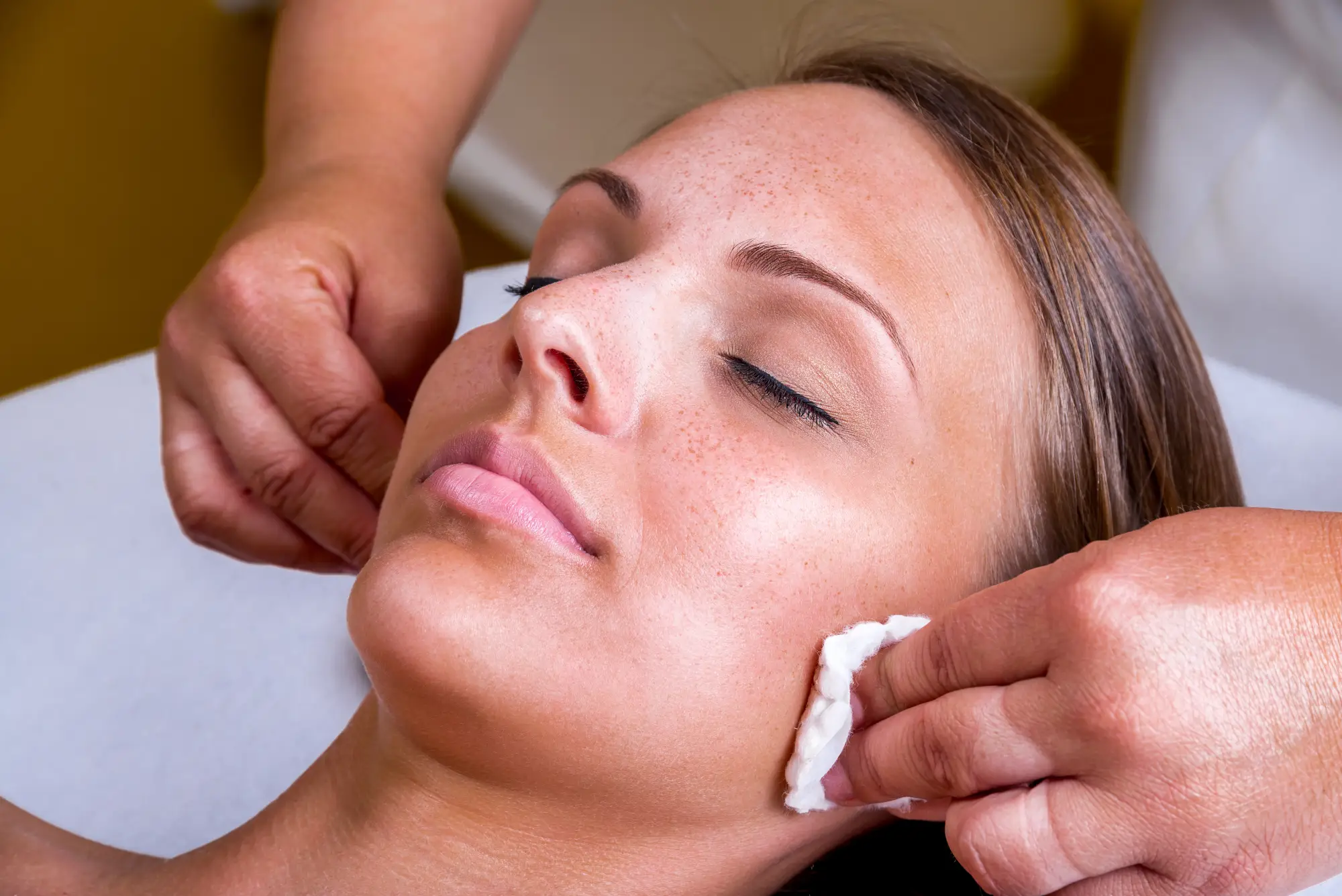 Chemical Peel at Glamify Medspa in Ashburn, VA