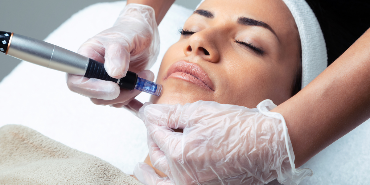 Best Age to Start Microneedling Preventative vs. Corrective Approaches